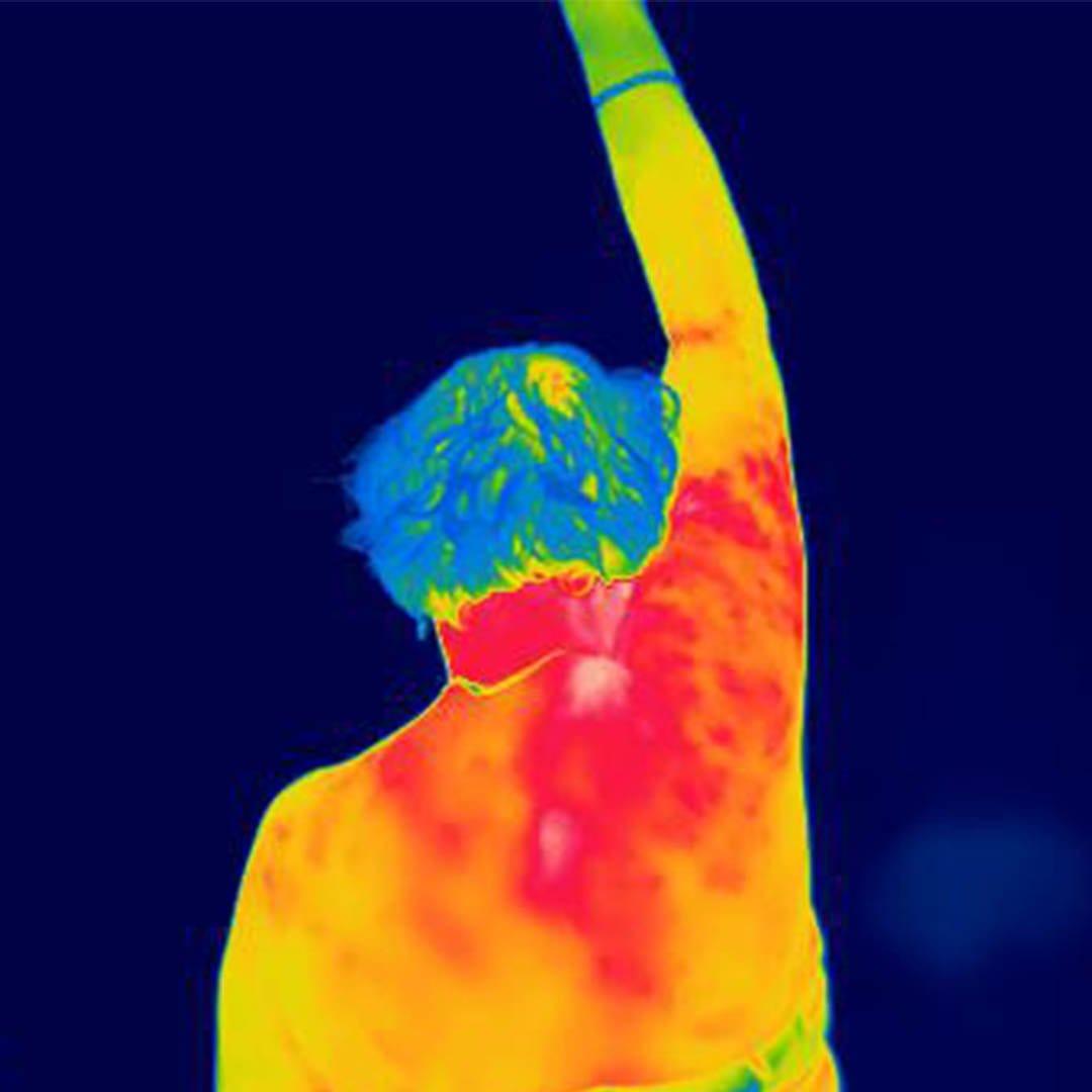 Research: New treatment for Frozen Shoulder